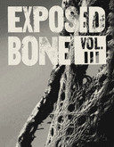 Exposed Bone
