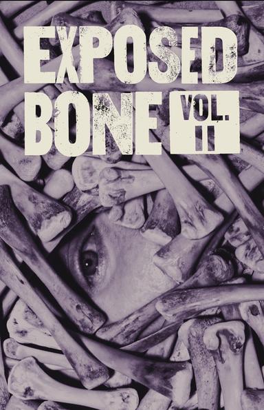 Exposed Bone latest issue