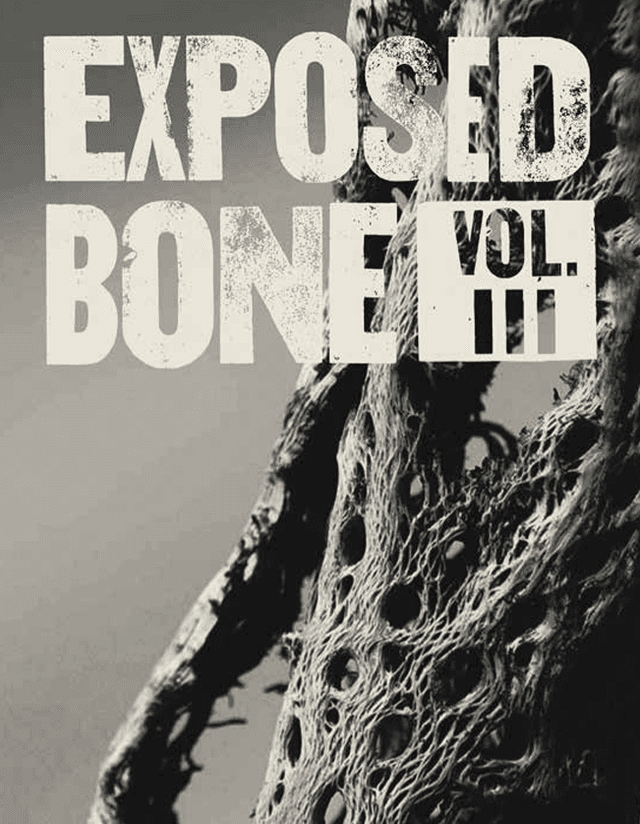 Exposed Bone latest issue